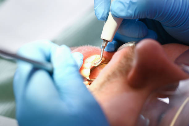 Best Mobile Emergency Dentist in Woodson Terrace, MO