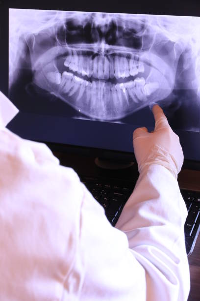 Best Emergency Dental Extractions in Woodson Terrace, MO