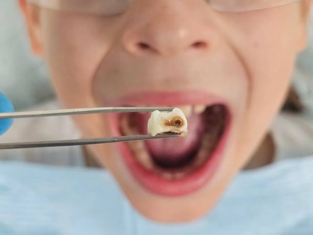  Woodson Terrace, MO Emergency Dentist Pros